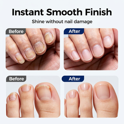 💅 2-in-1 Electric Nail Clipper & Smoother 🌟